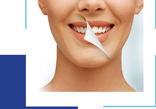 The Crucial Role Of Teeth Cleaning In Oral Health